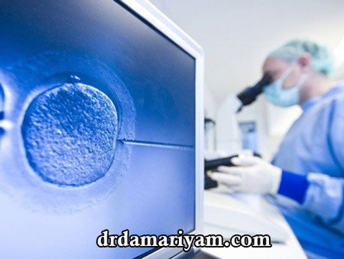 مراحل انجام IVF