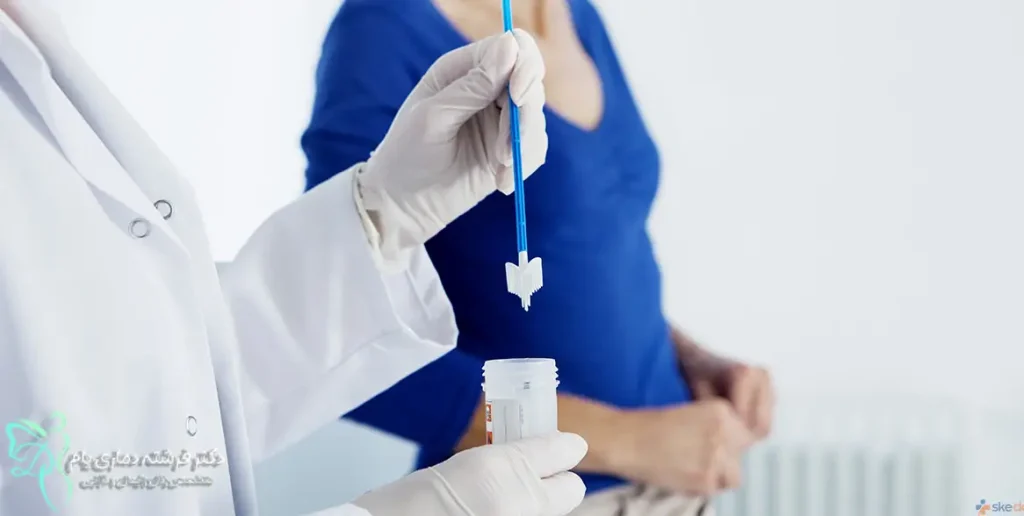 تست پاپ اسمیر