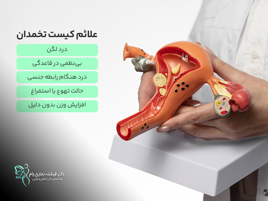 علائم کیست تخمدان