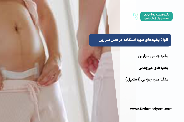انواع-بخیه‌های-مورد-استفاده-در-عمل-سزارین
